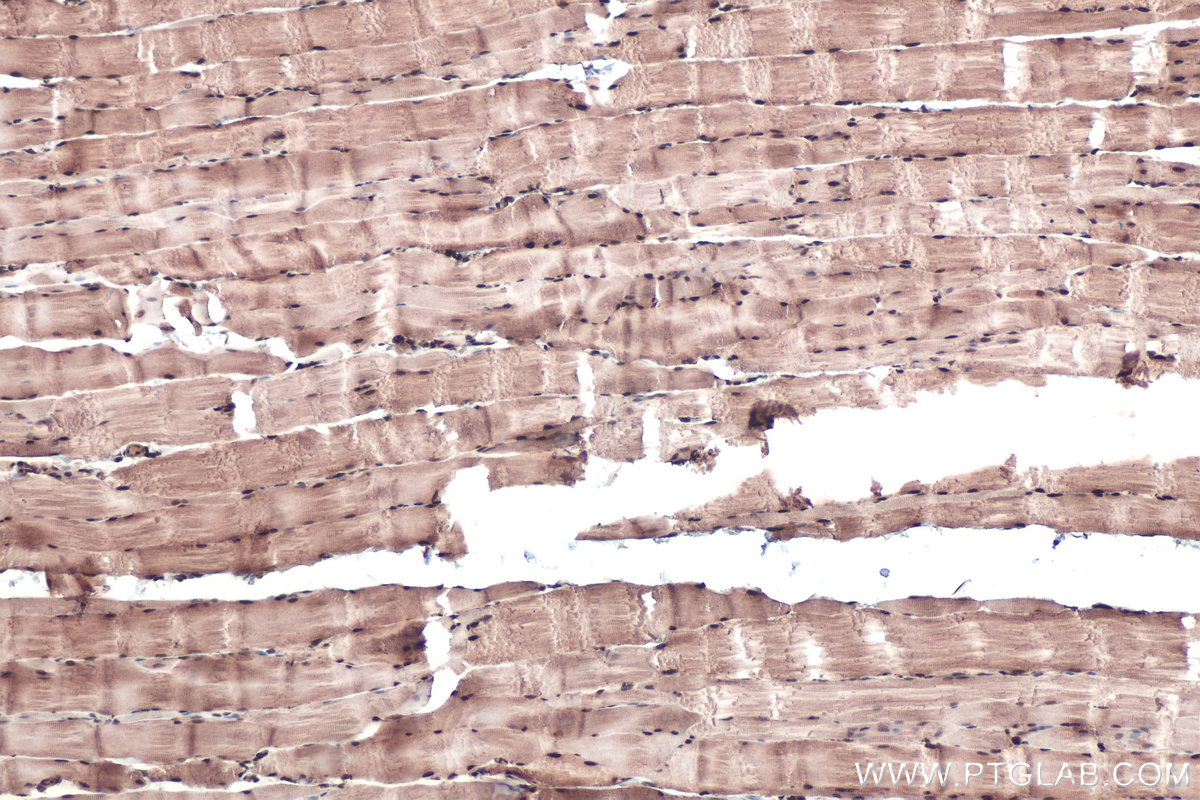 Immunohistochemical analysis of paraffin-embedded rat skeletal muscle tissue slide using KHC0433 (MBNL1 IHC Kit).