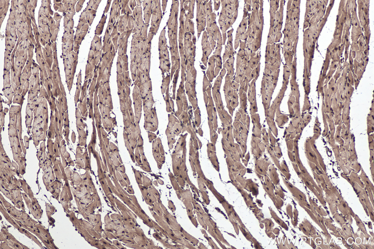 Immunohistochemical analysis of paraffin-embedded mouse heart tissue slide using KHC0433 (MBNL1 IHC Kit).