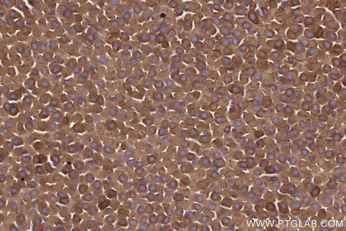 Immunohistochemical analysis of paraffin-embedded mouse adrenal gland tissue slide using KHC2808 (MBOAT7 IHC Kit).