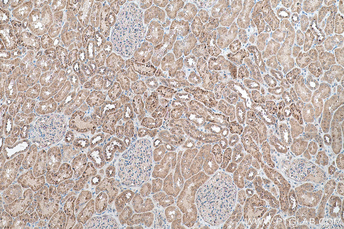 Immunohistochemical analysis of paraffin-embedded human kidney tissue slide using KHC0759 (MCC IHC Kit).