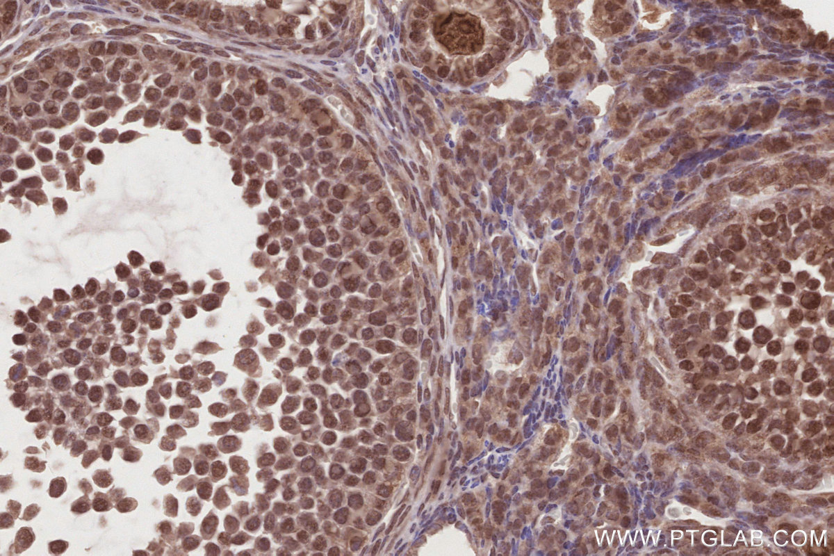 Immunohistochemical analysis of paraffin-embedded mouse ovary tissue slide using KHC2867 (MCM-BP IHC Kit).