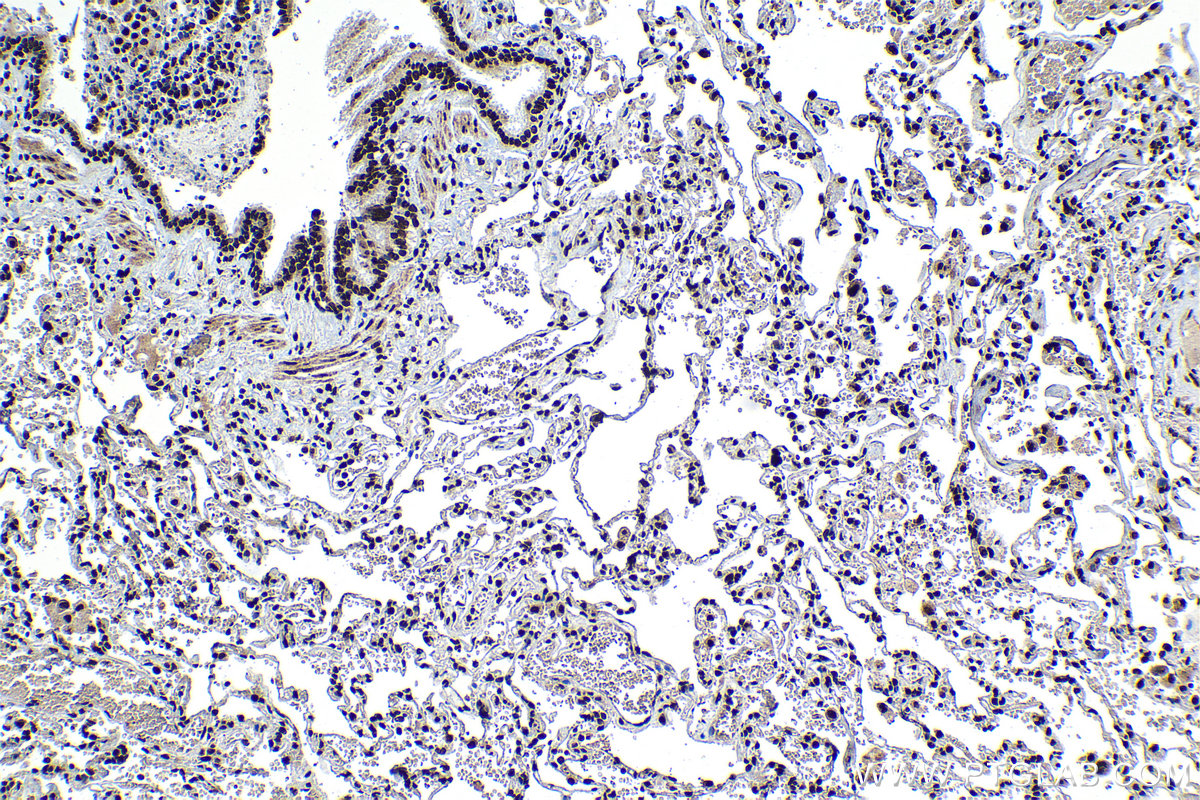 Immunohistochemical analysis of paraffin-embedded human lung tissue slide using KHC1325 (MCM6 IHC Kit).