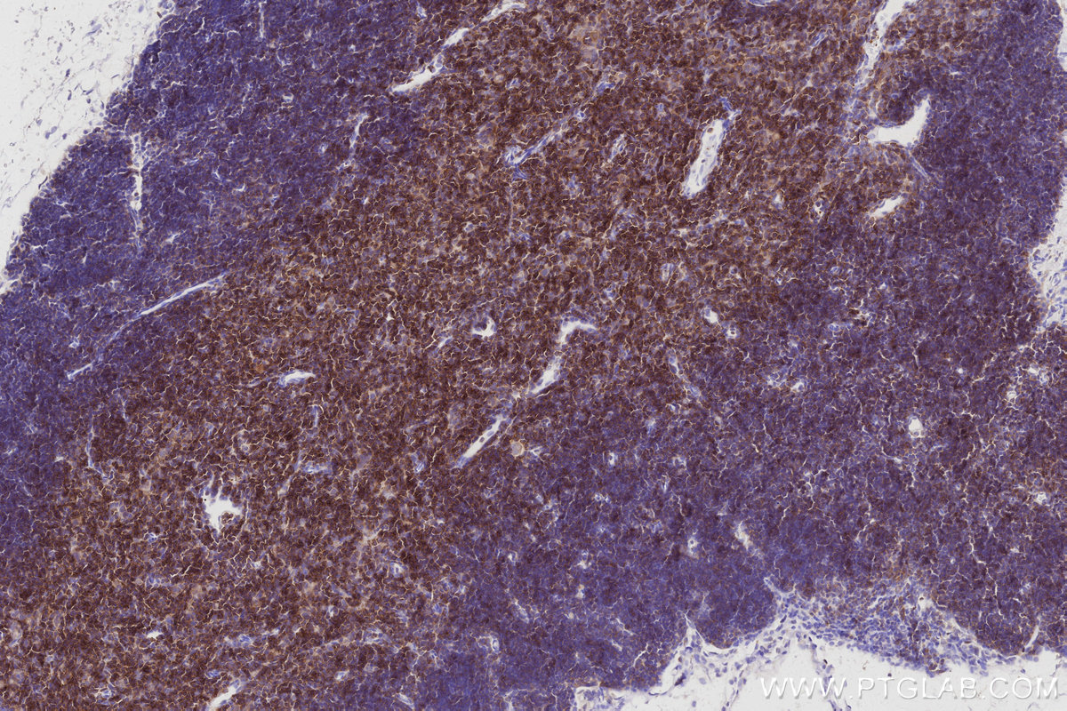 Immunohistochemical analysis of paraffin-embedded mouse thymus tissue slide using KHC3032 (MCTS1 IHC Kit). Immunohistochemical analysis of paraffin-embedded mouse thymus tissue slide using KHC3032 (MCTS1 IHC Kit).