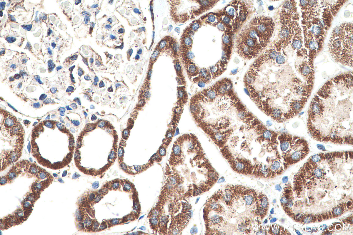 Immunohistochemical analysis of paraffin-embedded human kidney tissue slide using KHC0524 (MDH2 IHC Kit).