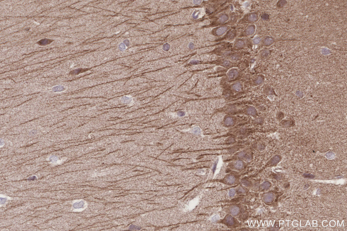 Immunohistochemical analysis of paraffin-embedded rat brain tissue slide using KHC3199 (ME2 IHC Kit).