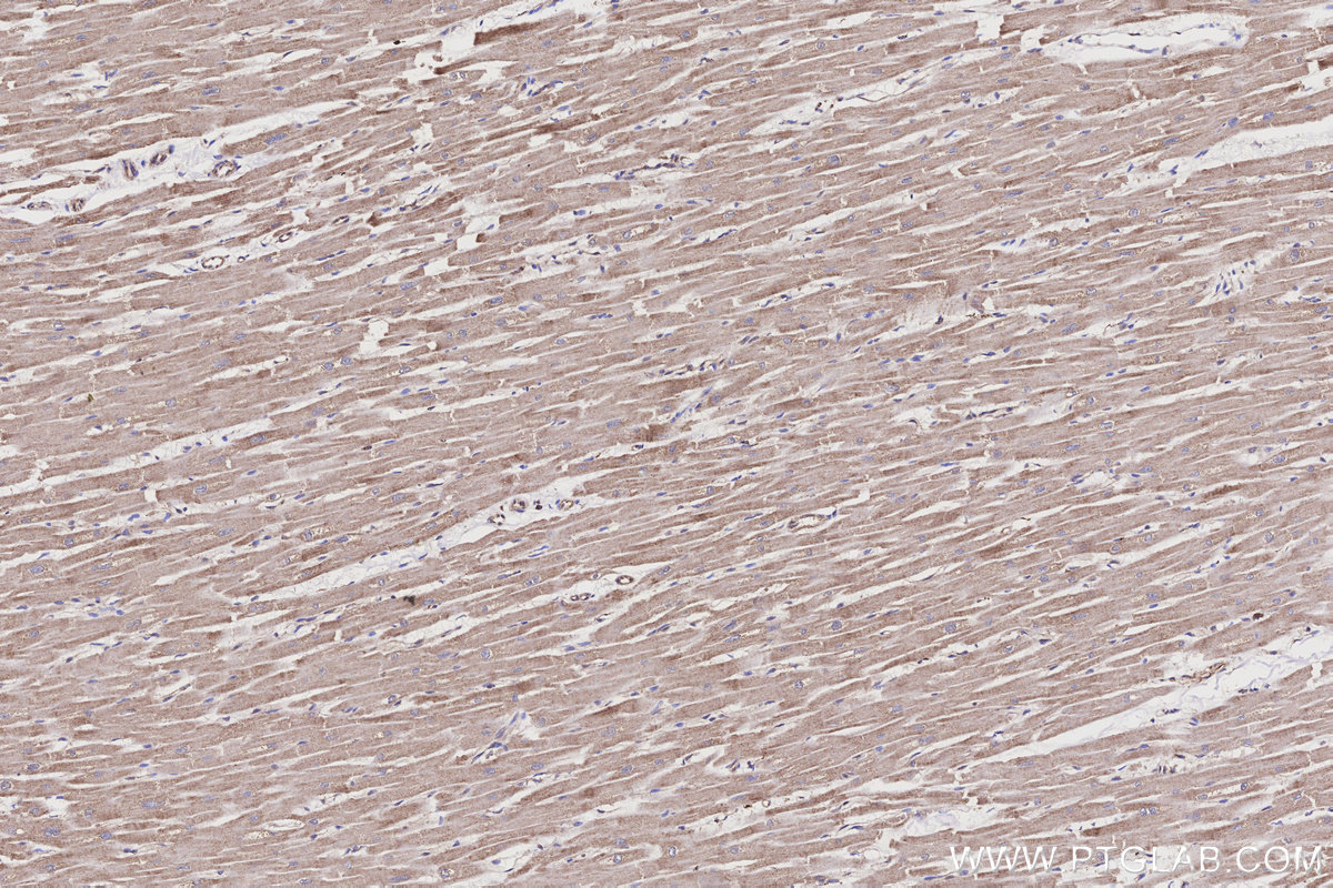 Immunohistochemical analysis of paraffin-embedded human heart tissue slide using KHC3199 (ME2 IHC Kit).