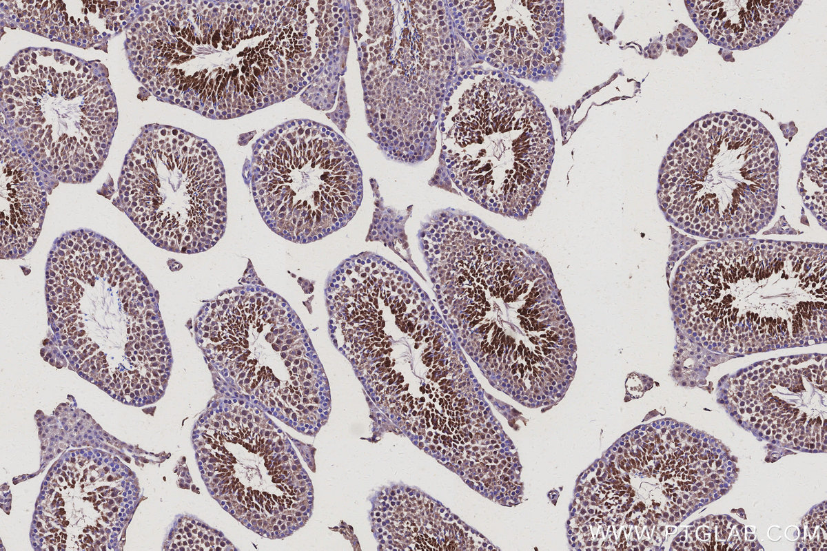 Immunohistochemical analysis of paraffin-embedded mouse testis tissue slide using KHC3125 (MEA1 IHC Kit).
