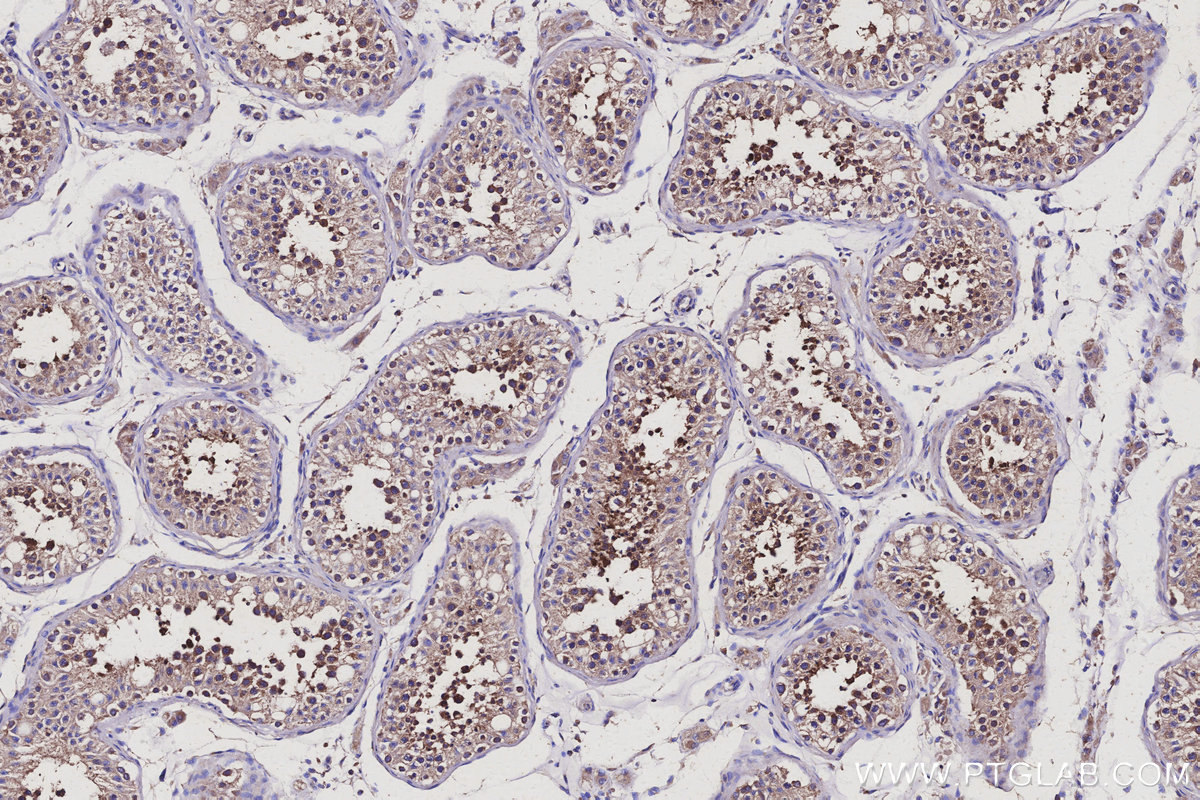 Immunohistochemical analysis of paraffin-embedded human testis tissue slide using KHC3125 (MEA1 IHC Kit).