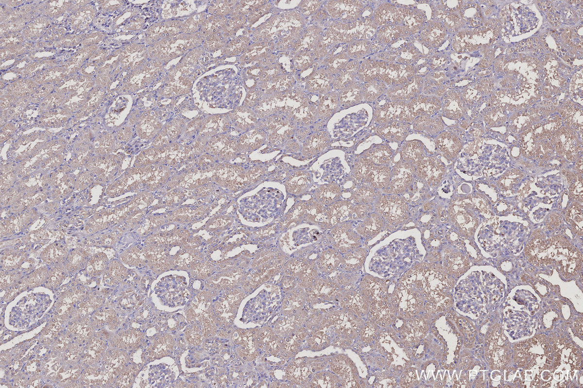 Immunohistochemical analysis of paraffin-embedded human kidney tissue slide using KHC3125 (MEA1 IHC Kit).
