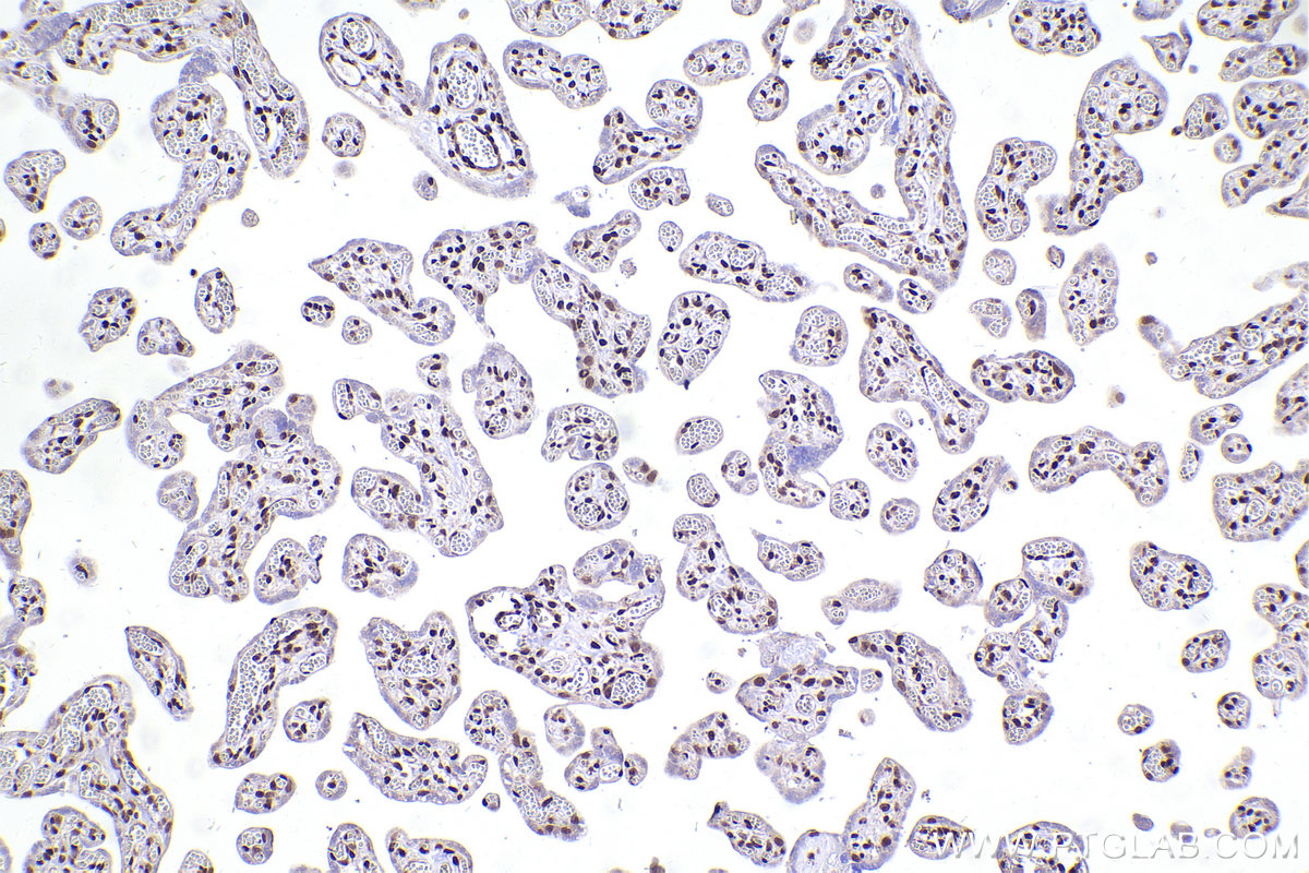 Immunohistochemical analysis of paraffin-embedded human placenta tissue slide using KHC2469 (MEF2D IHC Kit).