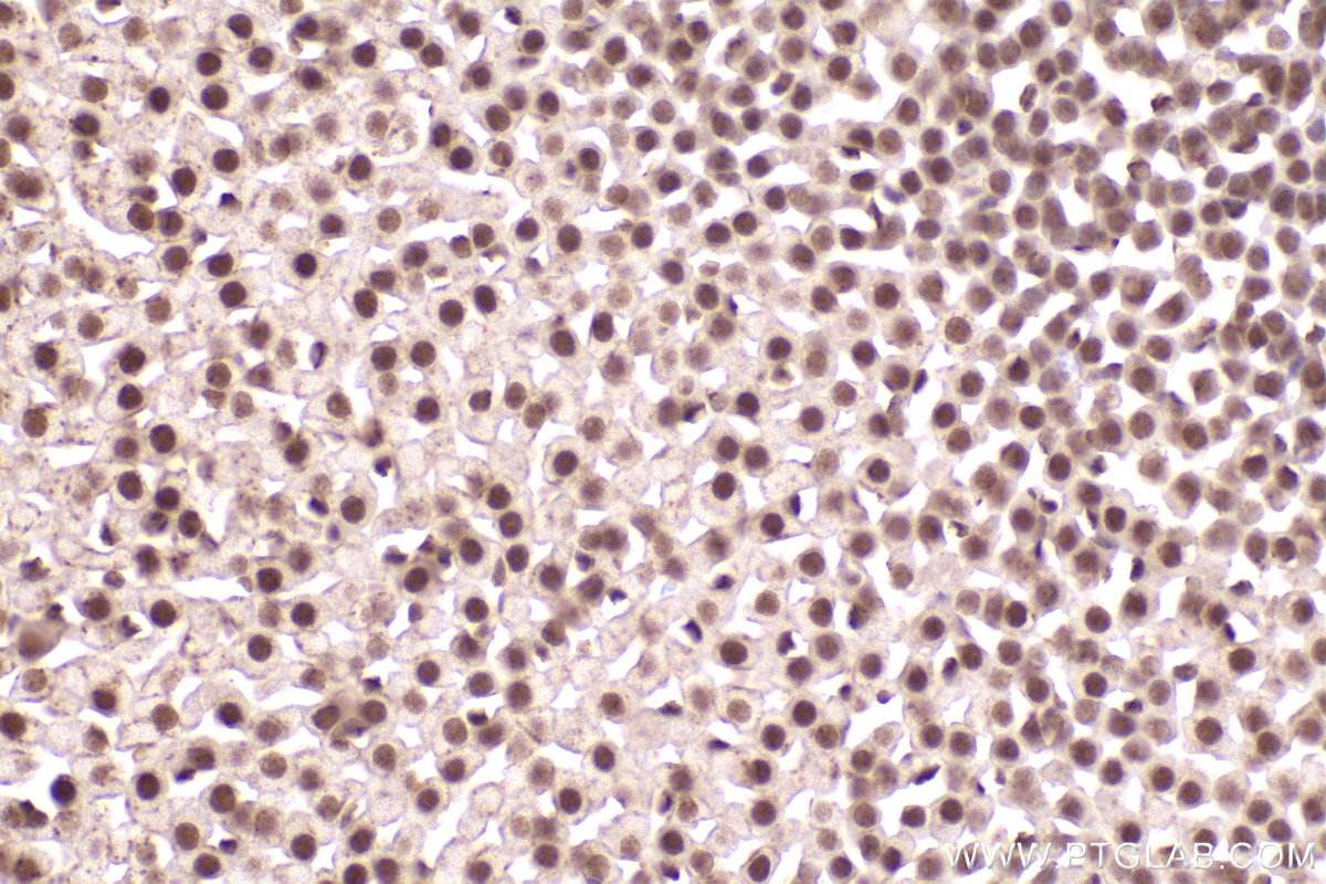 Immunohistochemical analysis of paraffin-embedded mouse adrenal gland tissue slide using KHC2469 (MEF2D IHC Kit).