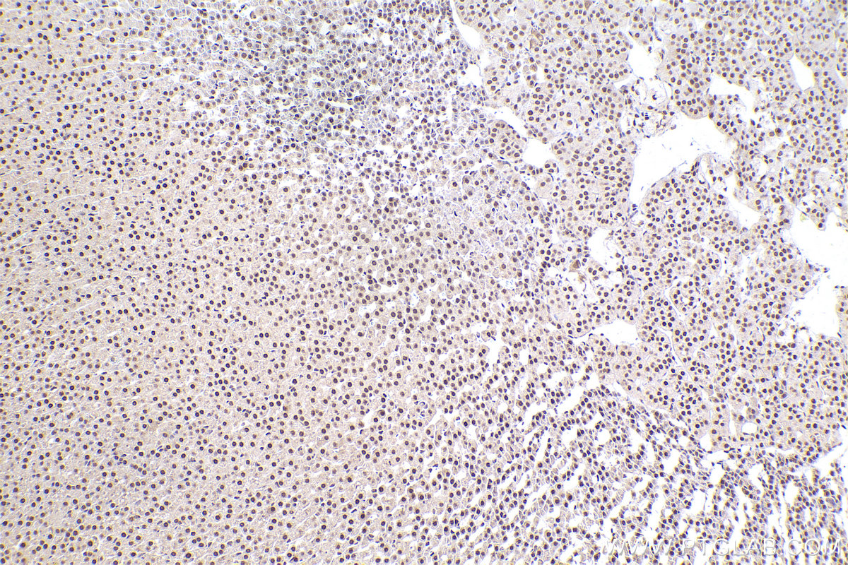 Immunohistochemical analysis of paraffin-embedded rat adrenal gland tissue slide using KHC2469 (MEF2D IHC Kit).