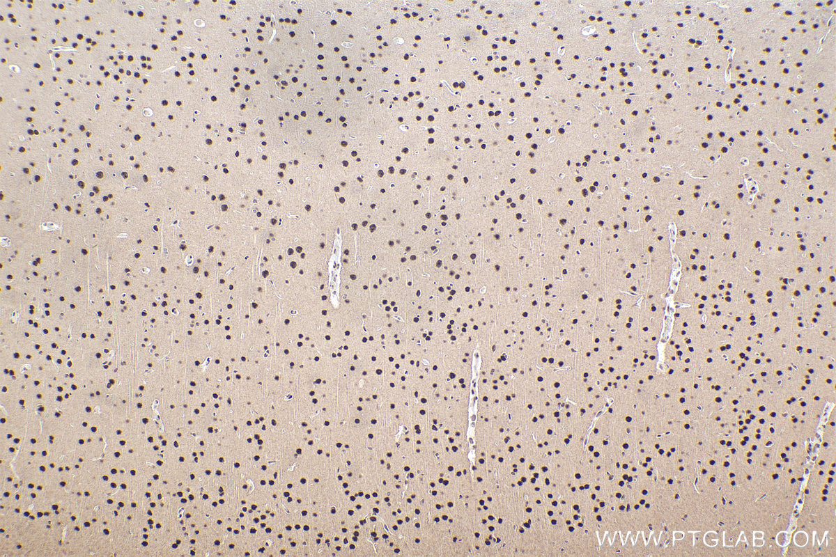 Immunohistochemical analysis of paraffin-embedded rat brain tissue slide using KHC2469 (MEF2D IHC Kit).