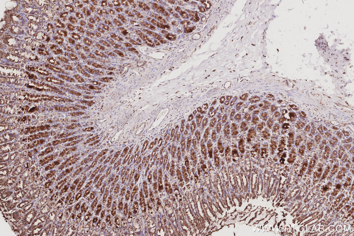 Immunohistochemical analysis of paraffin-embedded rat stomach tissue slide using KHC3058 (MEKK2 IHC Kit). Immunohistochemical analysis of paraffin-embedded rat stomach tissue slide using KHC3058 (MEKK2 IHC Kit).