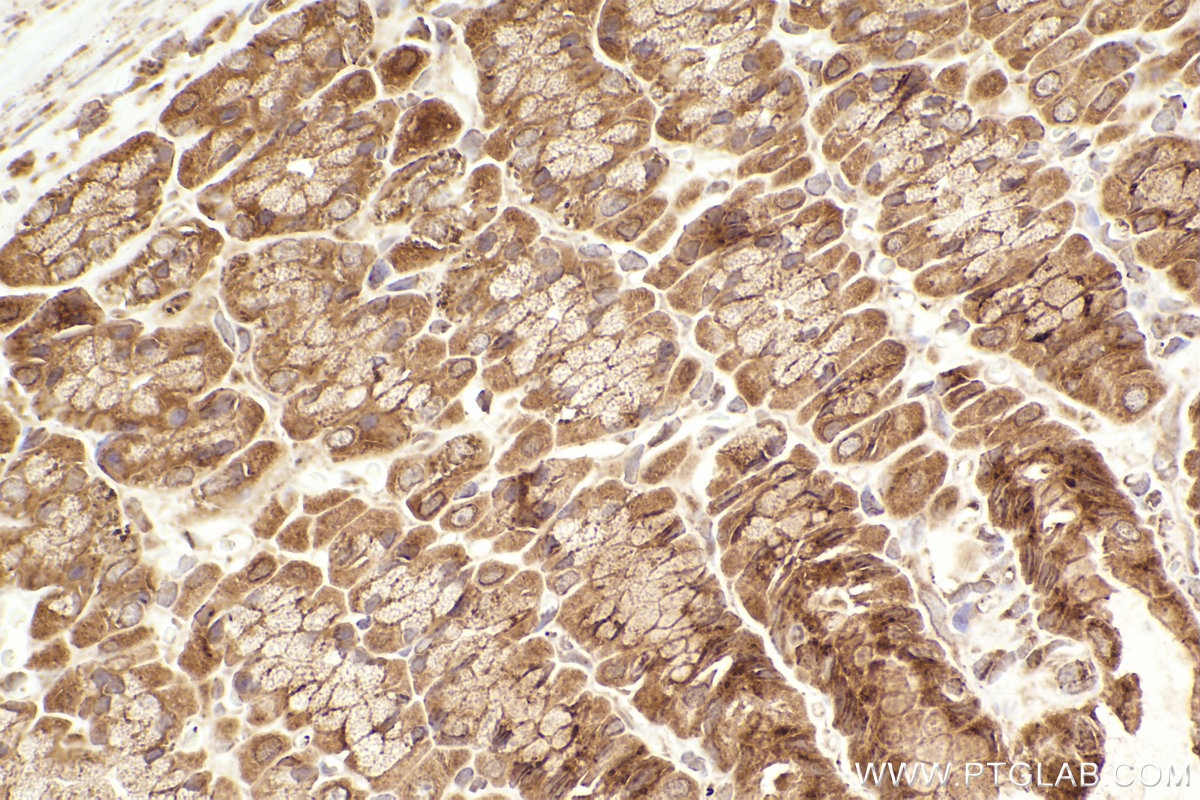 Immunohistochemical analysis of paraffin-embedded rat stomach tissue slide using KHC2464 (MELK IHC Kit).