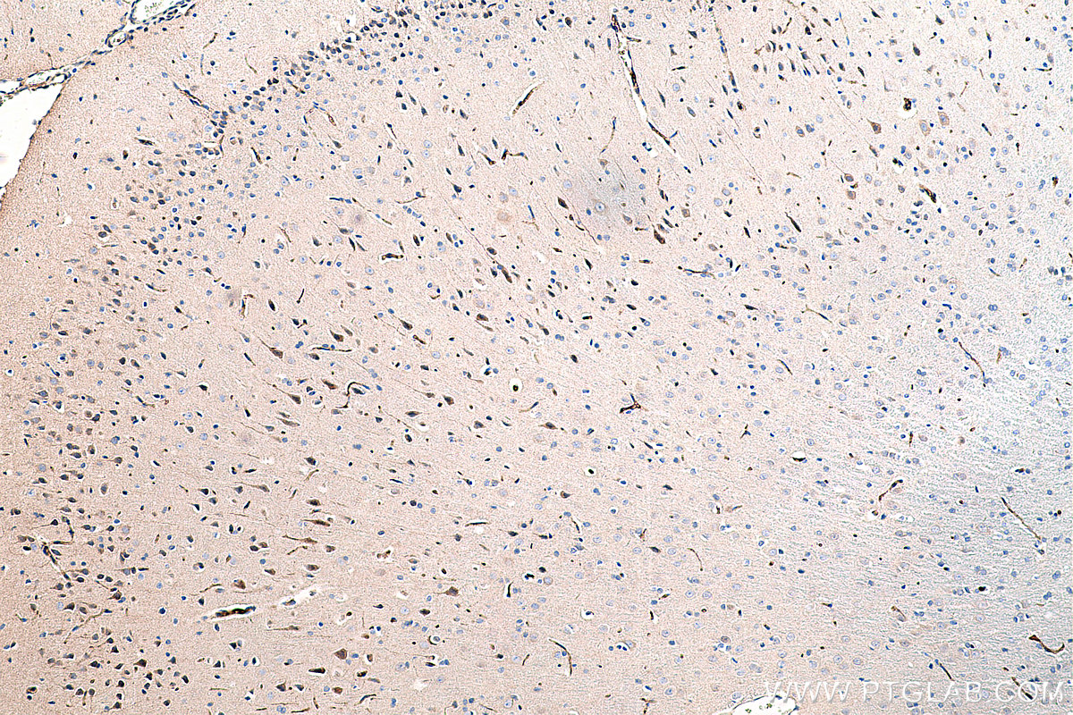 Immunohistochemical analysis of paraffin-embedded rat brain tissue slide using KHC0250 (MEST IHC Kit).