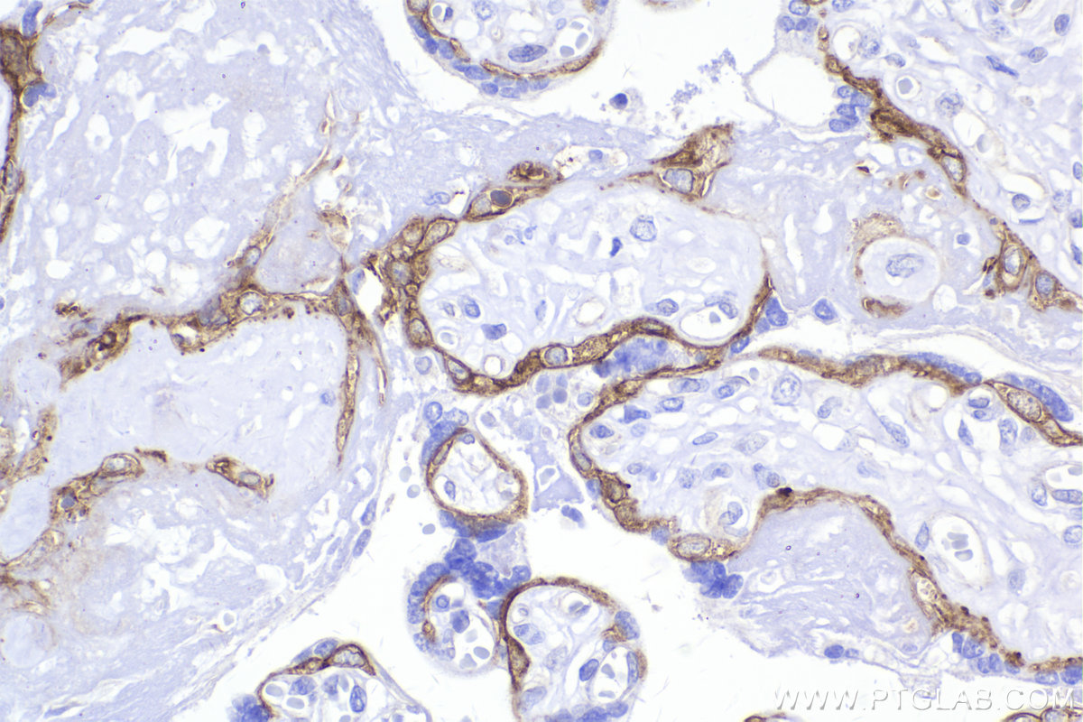Immunohistochemical analysis of paraffin-embedded human placenta tissue slide using KHC2170 (MET IHC Kit).