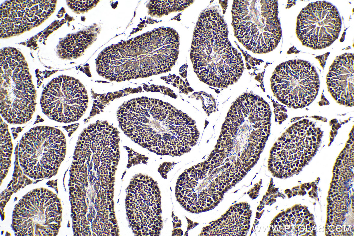 Immunohistochemical analysis of paraffin-embedded mouse testis tissue slide using KHC0145 (METTL14 IHC Kit).