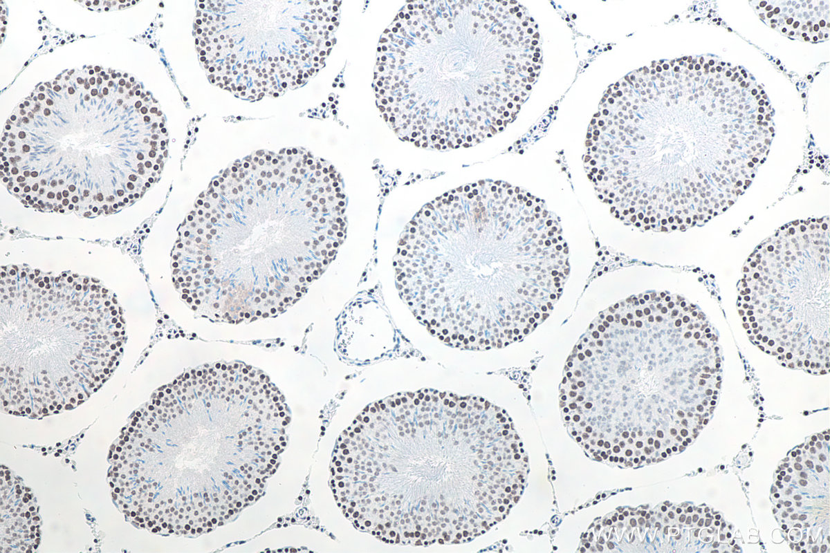 Immunohistochemical analysis of paraffin-embedded rat testis tissue slide using KHC0061 (METTL3 IHC Kit).