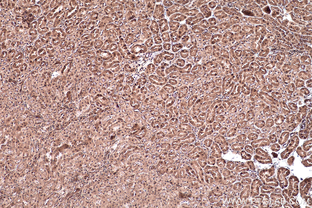 Immunohistochemical analysis of paraffin-embedded mouse kidney tissue slide using KHC0147 (METTL5 IHC Kit).