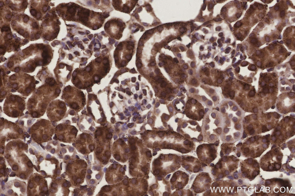 Immunohistochemical analysis of paraffin-embedded mouse kidney tissue slide using KHC3275 (METTL7B IHC Kit).