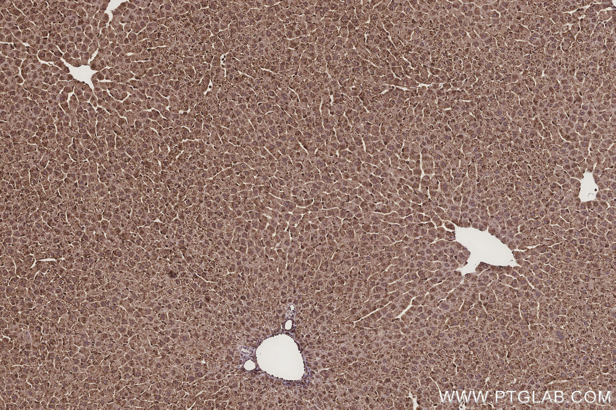 Immunohistochemical analysis of paraffin-embedded rat liver tissue slide using KHC3275 (METTL7B IHC Kit).