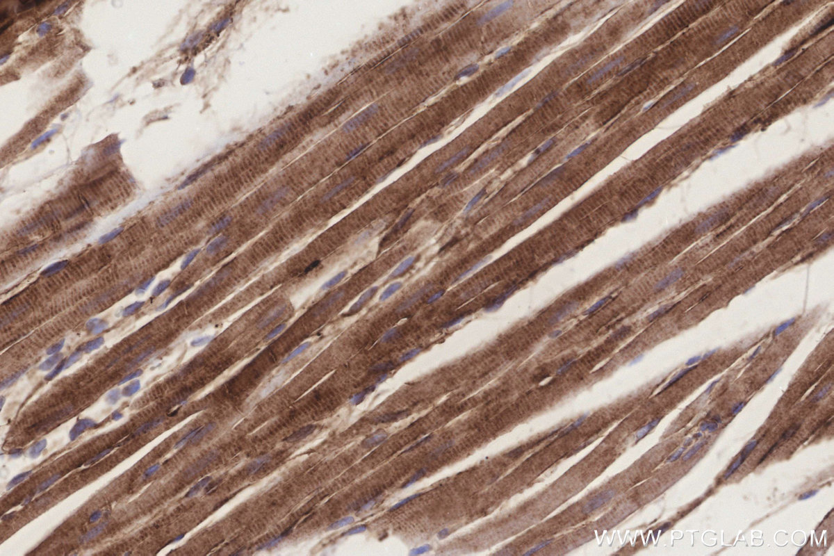 Immunohistochemical analysis of paraffin-embedded rat heart tissue slide using KHC3248 (MGAT2 IHC Kit).