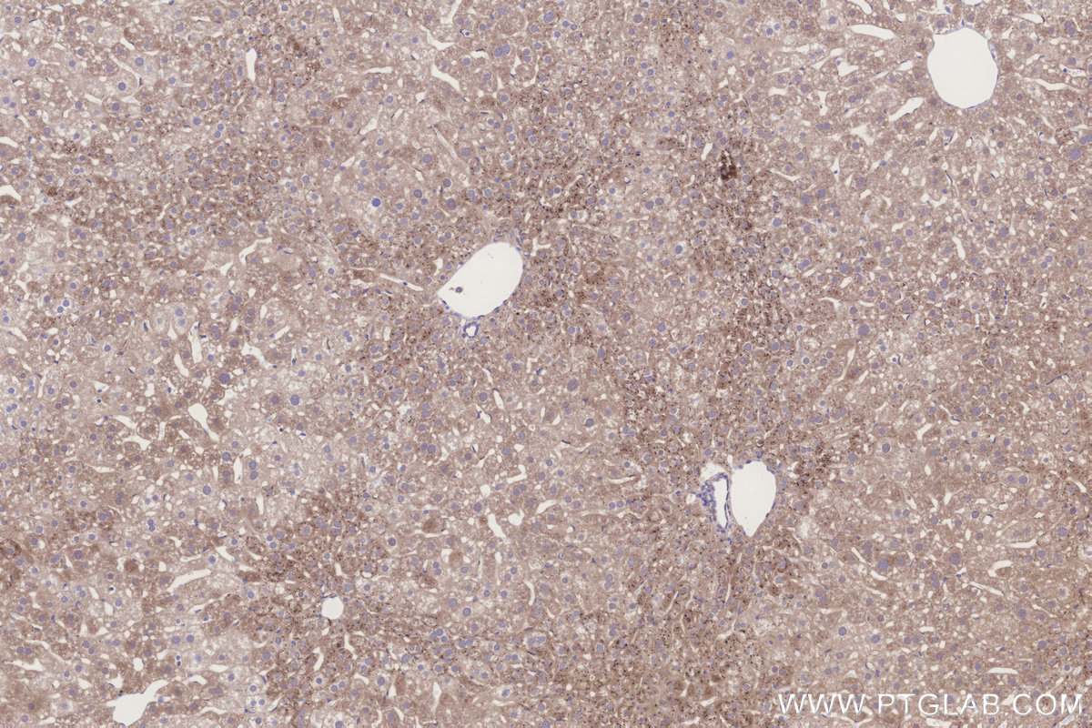Immunohistochemical analysis of paraffin-embedded mouse liver tissue slide using KHC3248 (MGAT2 IHC Kit).