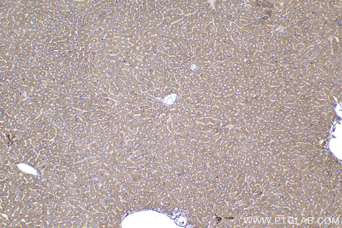 Immunohistochemical analysis of paraffin-embedded mouse liver tissue slide using KHC1484 (MICAL2 IHC Kit).