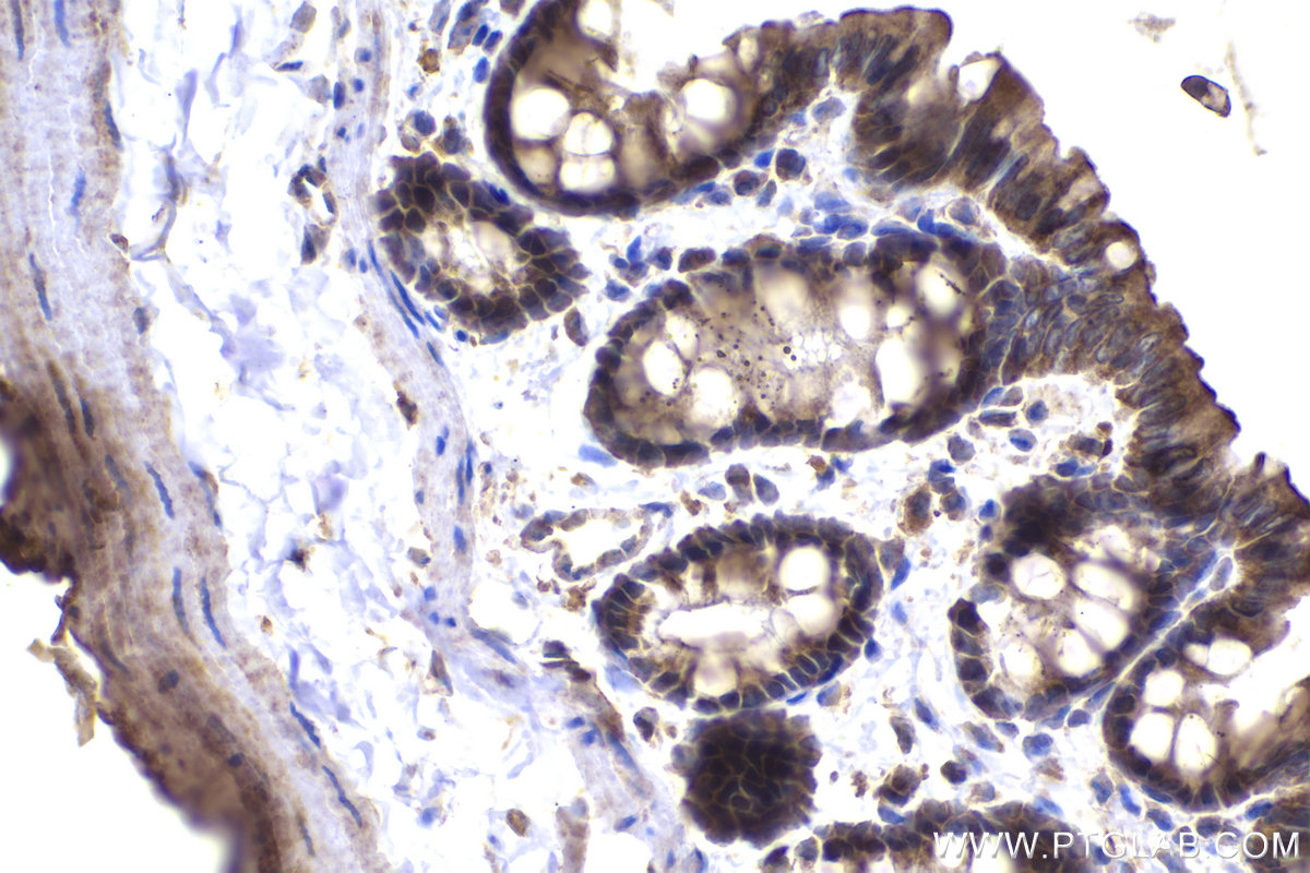 Immunohistochemical analysis of paraffin-embedded rat colon tissue slide using KHC1484 (MICAL2 IHC Kit).