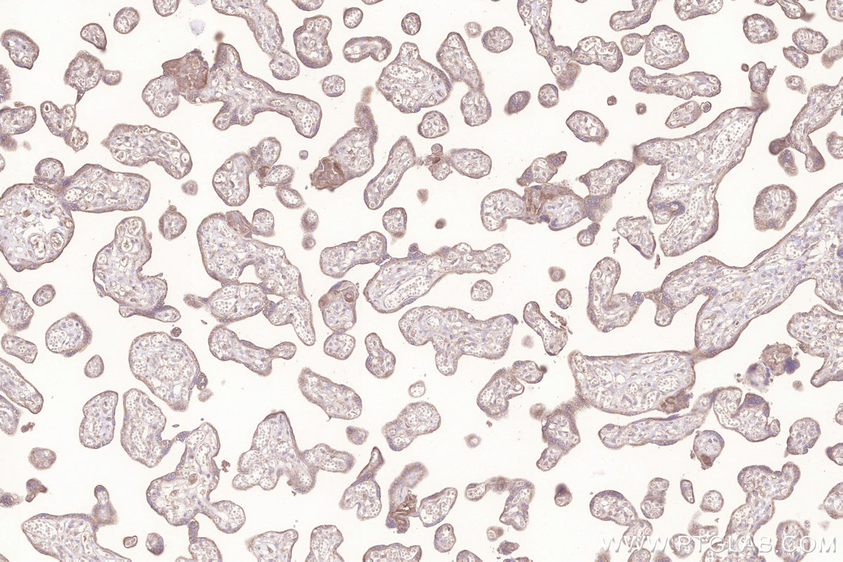 Immunohistochemical analysis of paraffin-embedded human placenta tissue slide using KHC3277 (MIGA2/FAM73B IHC Kit). Immunohistochemical analysis of paraffin-embedded human placenta tissue slide using KHC3277 (MIGA2/FAM73B IHC Kit).