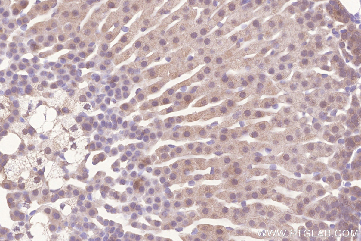 Immunohistochemical analysis of paraffin-embedded mouse adrenal gland tissue slide using KHC3277 (MIGA2/FAM73B IHC Kit). Immunohistochemical analysis of paraffin-embedded mouse adrenal gland tissue slide using KHC3277 (MIGA2/FAM73B IHC Kit).