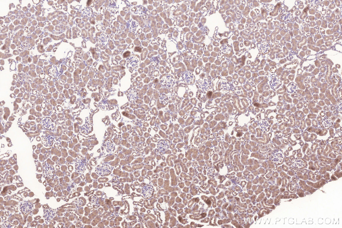 Immunohistochemical analysis of paraffin-embedded mouse kidney tissue slide using KHC3277 (MIGA2/FAM73B IHC Kit). Immunohistochemical analysis of paraffin-embedded mouse kidney tissue slide using KHC3277 (MIGA2/FAM73B IHC Kit).