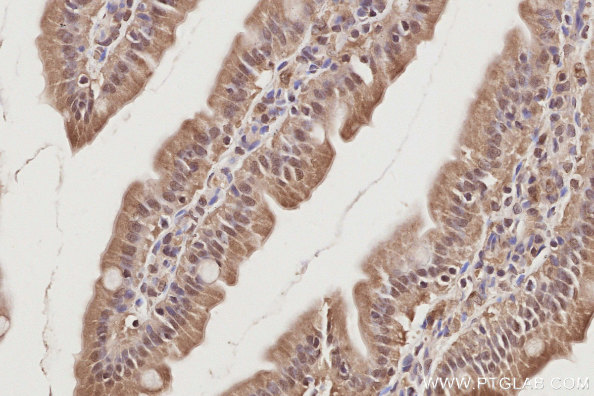 Immunohistochemical analysis of paraffin-embedded rat small intestine tissue slide using KHC2898 (MIS12 IHC Kit).