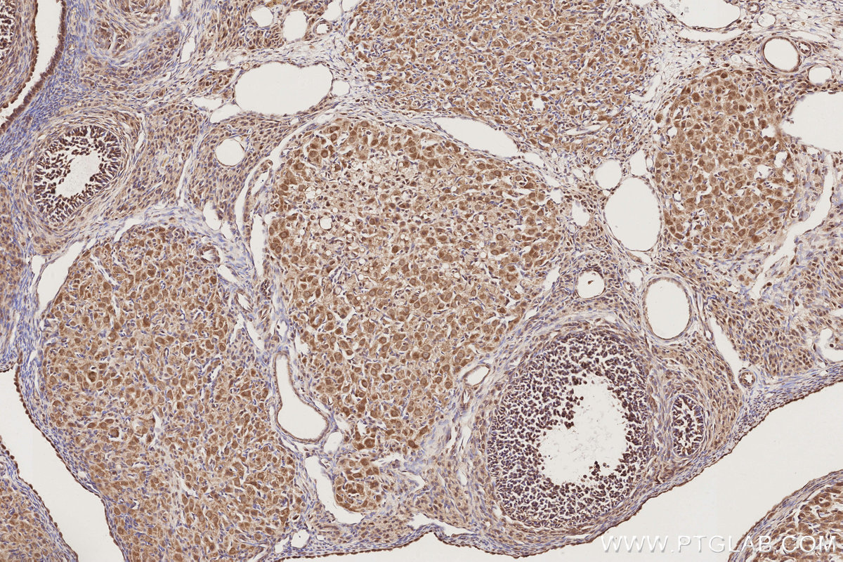 Immunohistochemical analysis of paraffin-embedded rat ovary tissue slide using KHC2898 (MIS12 IHC Kit).