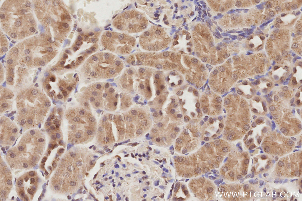 Immunohistochemical analysis of paraffin-embedded rat kidney tissue slide using KHC2898 (MIS12 IHC Kit).