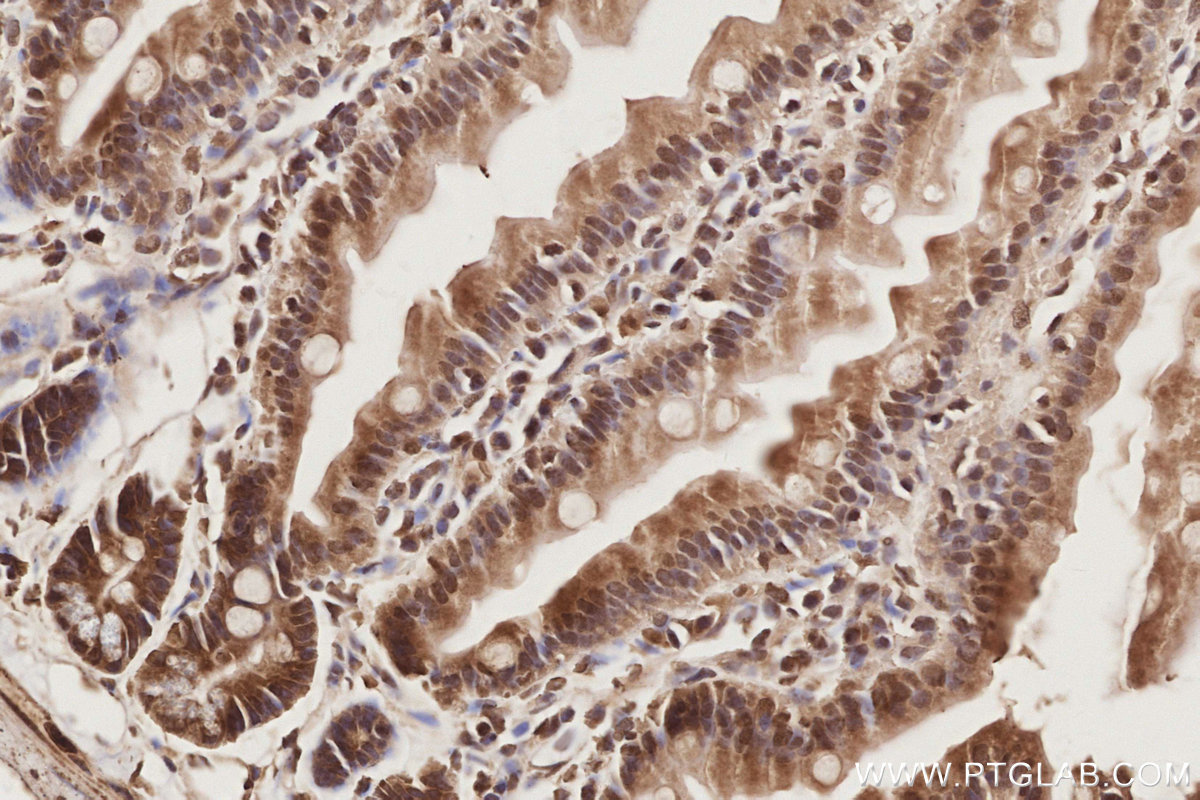 Immunohistochemical analysis of paraffin-embedded mouse small intestine tissue slide using KHC2898 (MIS12 IHC Kit).