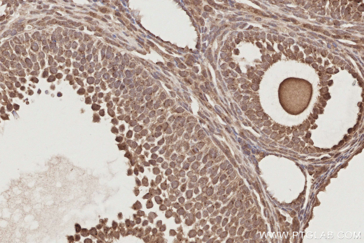 Immunohistochemical analysis of paraffin-embedded mouse ovary tissue slide using KHC2898 (MIS12 IHC Kit).