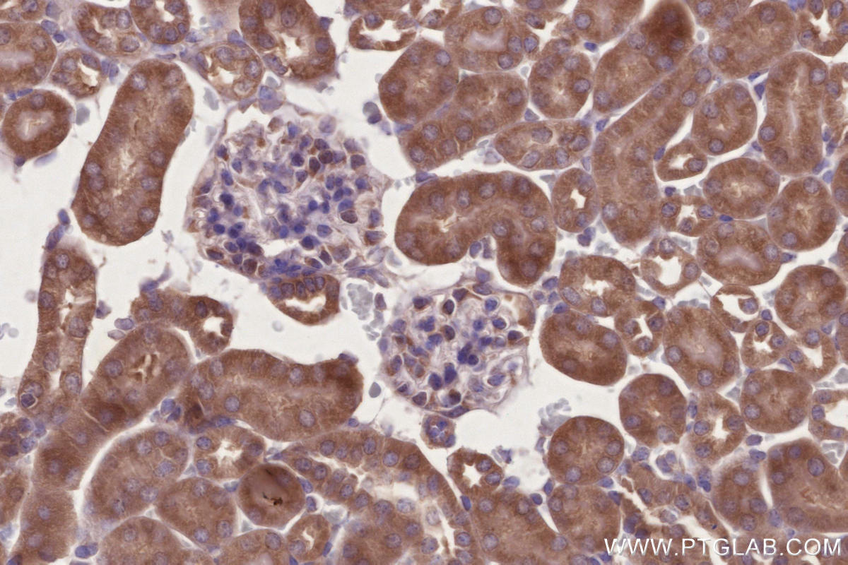 Immunohistochemical analysis of paraffin-embedded mouse kidney tissue slide using KHC2734 (MITD1 IHC Kit).