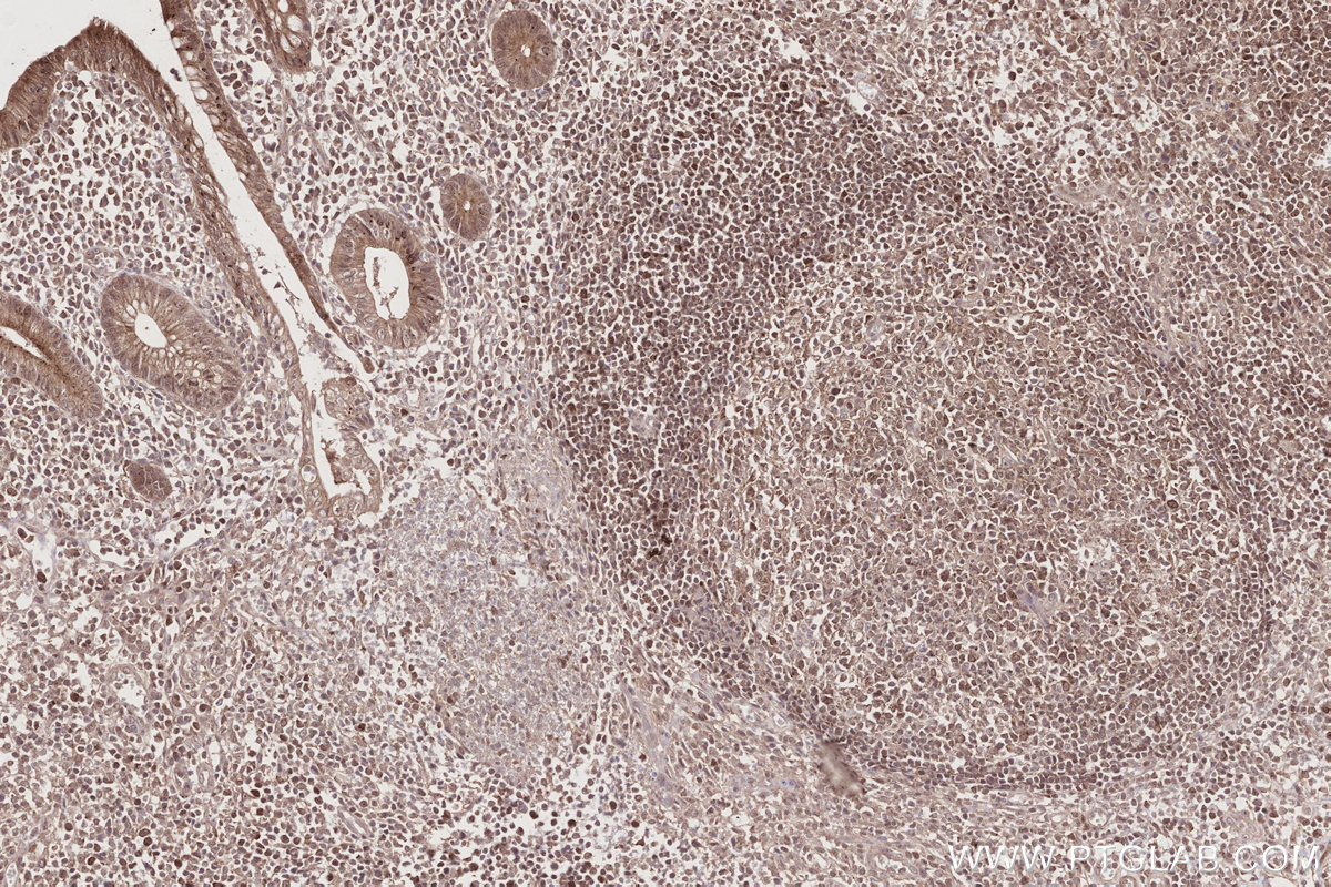 Immunohistochemical analysis of paraffin-embedded human appendicitis tissue slide using KHC2734 (MITD1 IHC Kit).