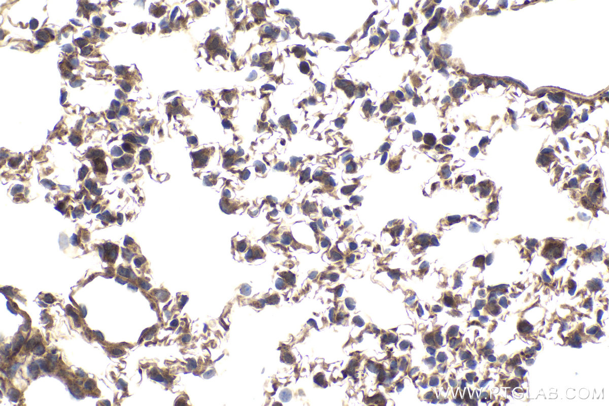 Immunohistochemical analysis of paraffin-embedded mouse lung tissue slide using KHC1957 (MKKS IHC Kit).