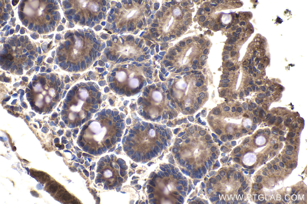 Immunohistochemical analysis of paraffin-embedded mouse small intestine tissue slide using KHC1957 (MKKS IHC Kit).