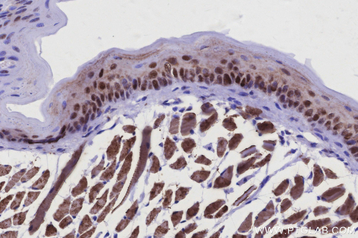 Immunohistochemical analysis of paraffin-embedded mouse tongue tissue slide using KHC2928 (MKNK2 IHC Kit).