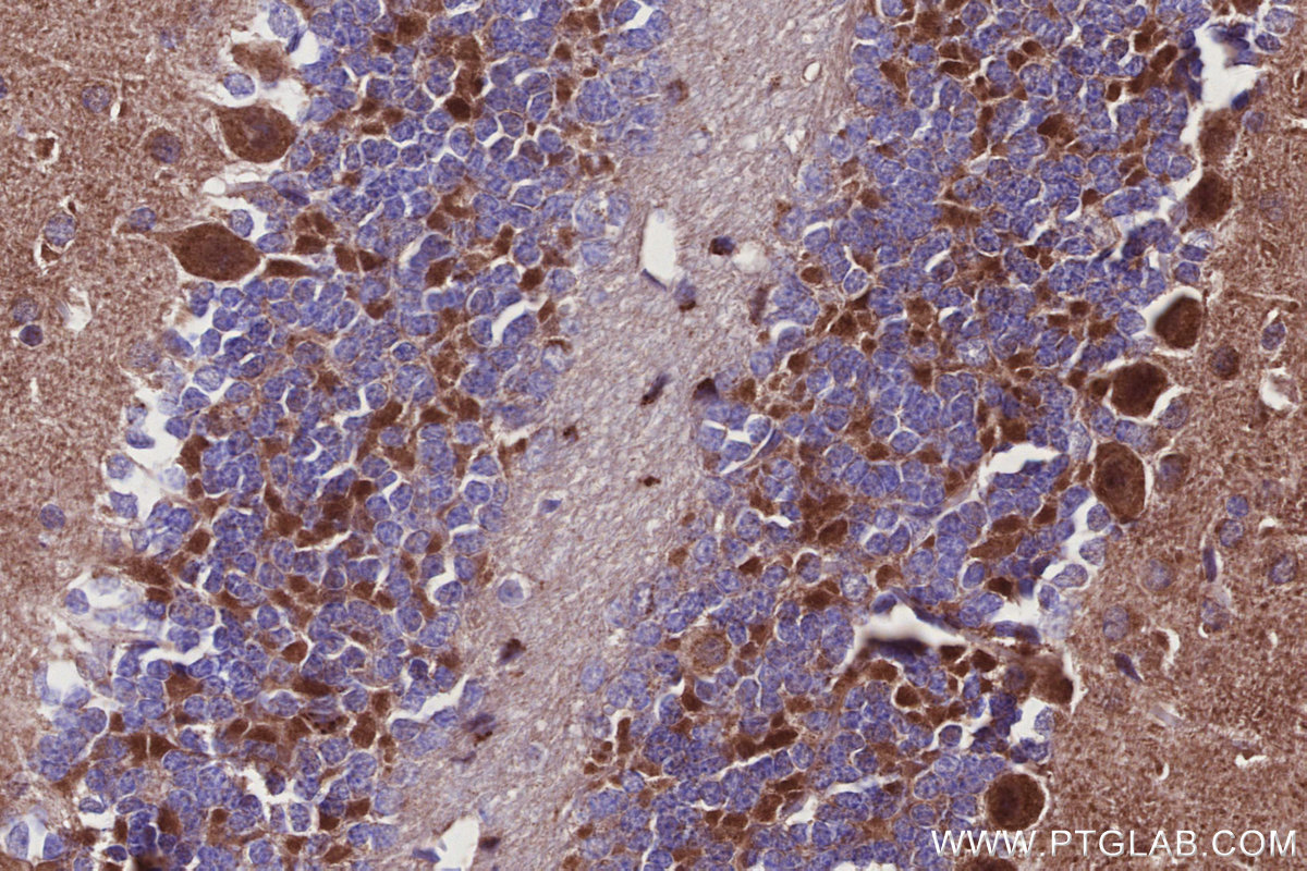 Immunohistochemical analysis of paraffin-embedded mouse cerebellum tissue slide using KHC2928 (MKNK2 IHC Kit).