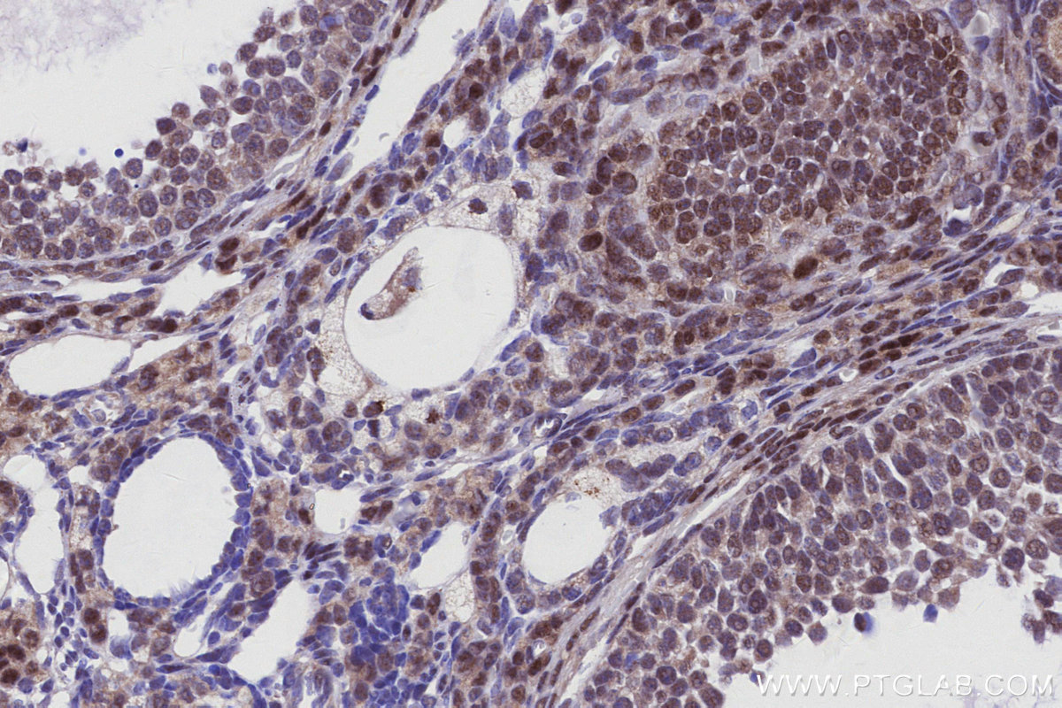 Immunohistochemical analysis of paraffin-embedded mouse ovary tissue slide using KHC2928 (MKNK2 IHC Kit).