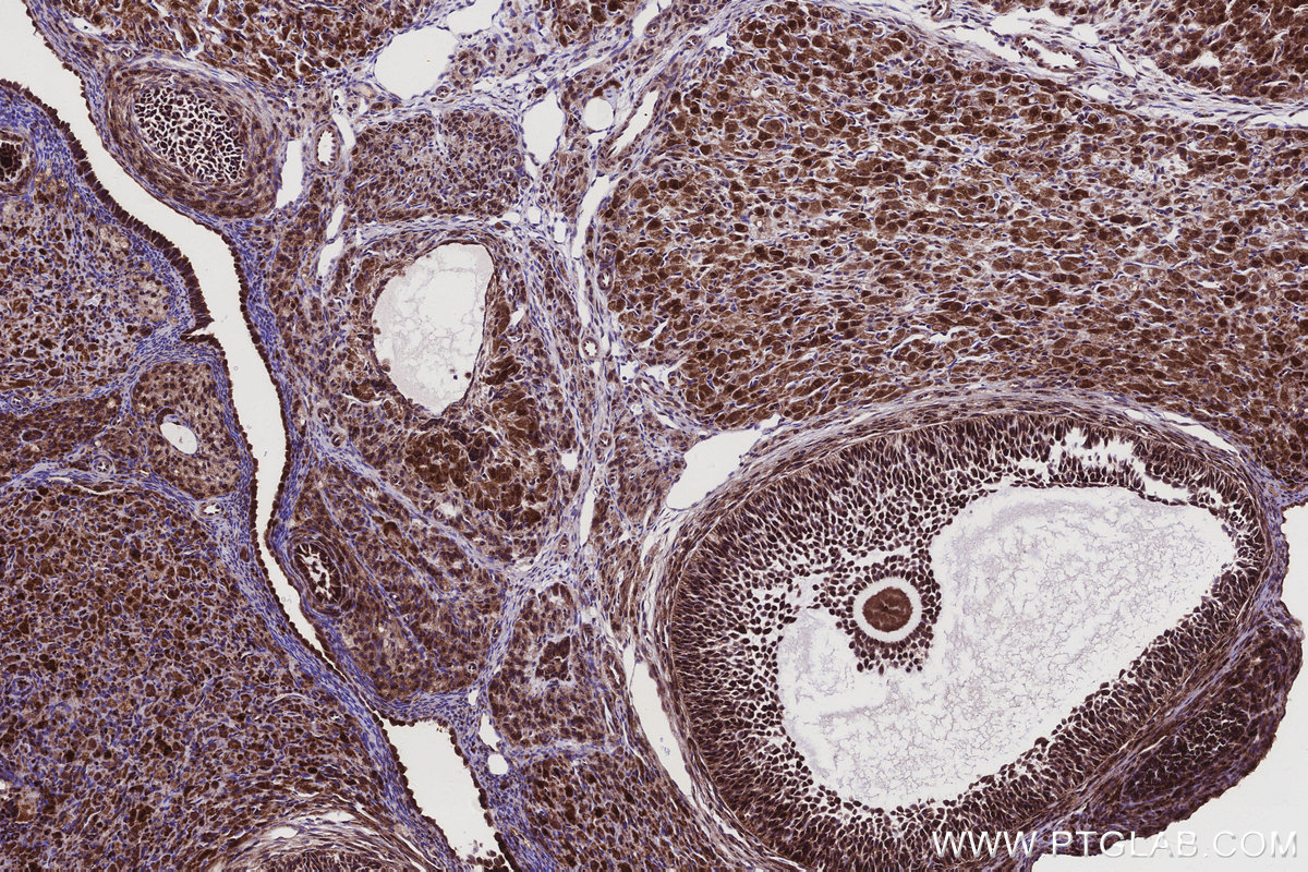 Immunohistochemical analysis of paraffin-embedded rat ovary tissue slide using KHC2928 (MKNK2 IHC Kit).