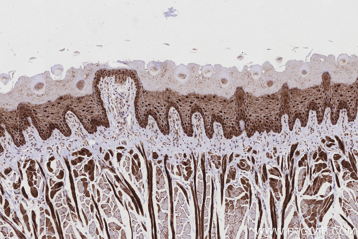 Immunohistochemical analysis of paraffin-embedded rat tongue tissue slide using KHC2928 (MKNK2 IHC Kit).