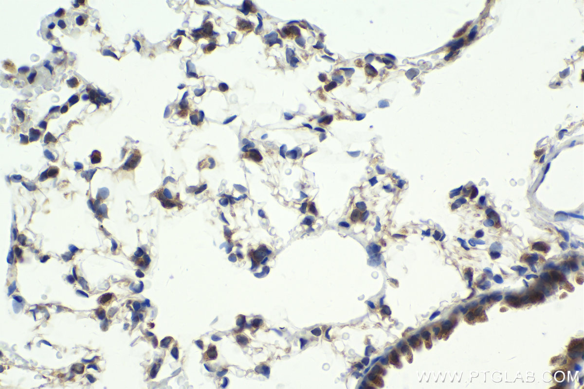 Immunohistochemical analysis of paraffin-embedded rat lung tissue slide using KHC1981 (MLX IHC Kit).