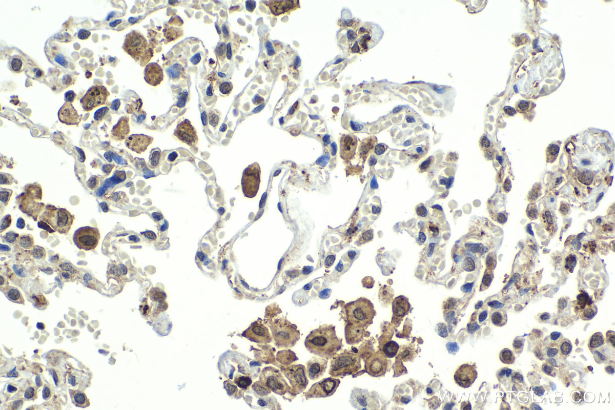 Immunohistochemical analysis of paraffin-embedded human lung tissue slide using KHC1981 (MLX IHC Kit).