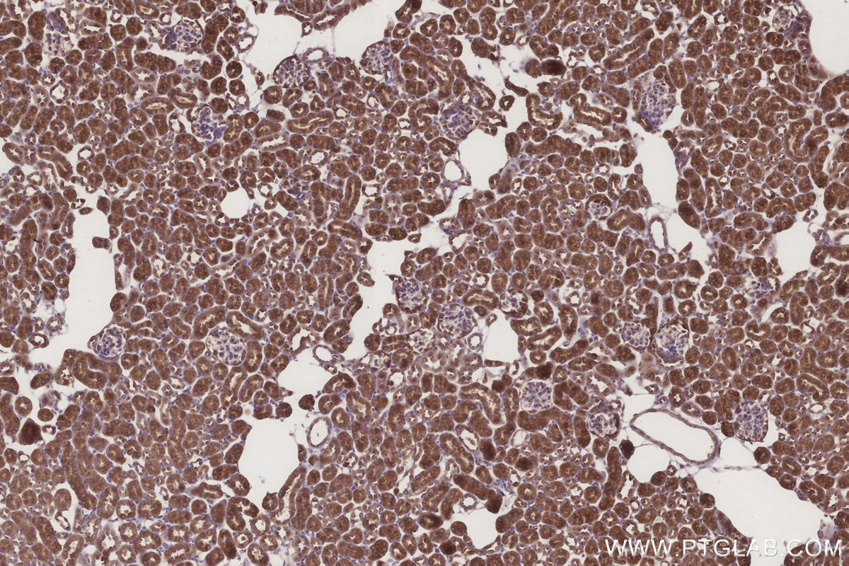 Immunohistochemical analysis of paraffin-embedded mouse kidney tissue slide using KHC3289 (MMGT1 IHC Kit).